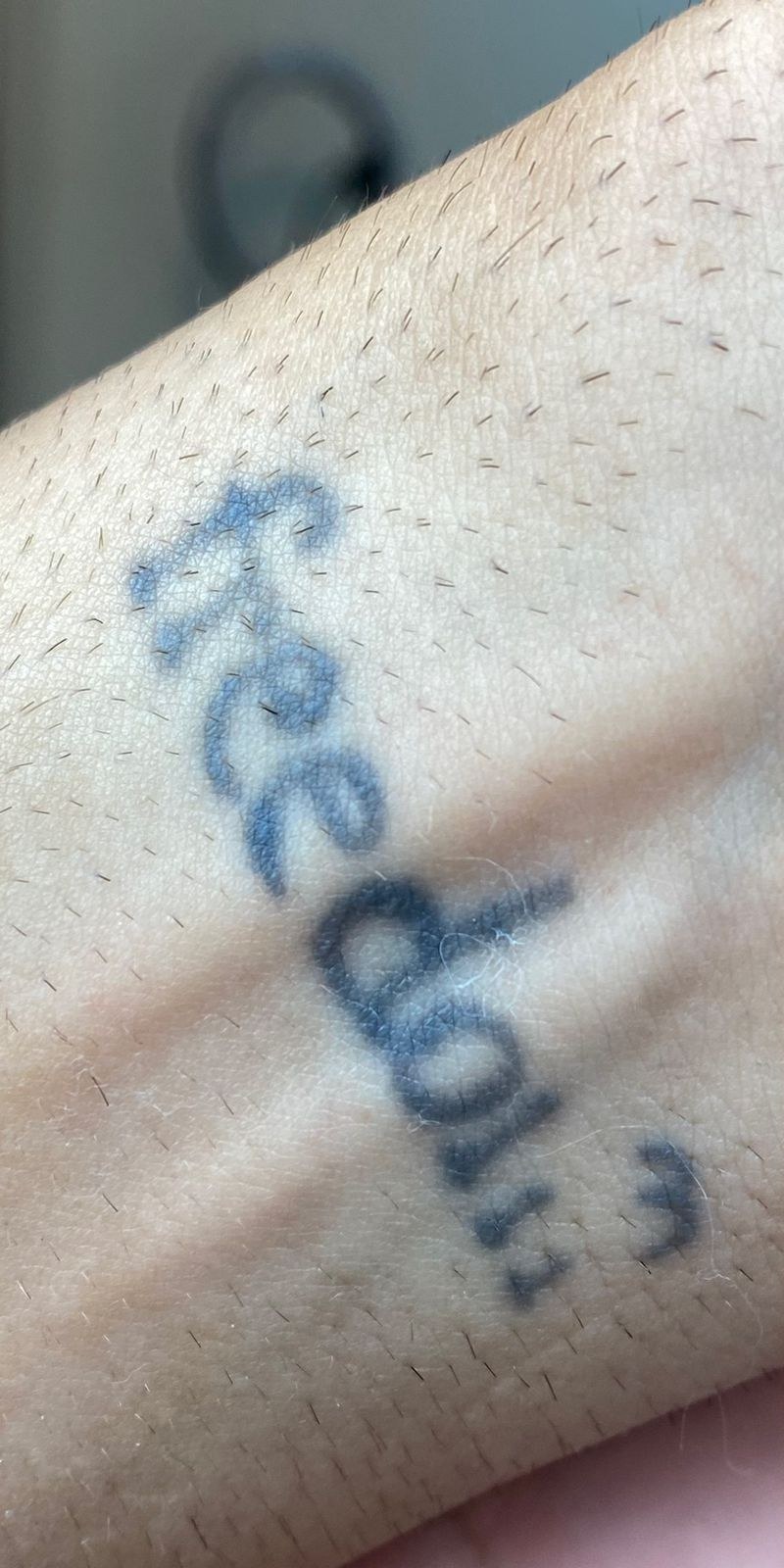 Tatuagem escrita antes da remoção