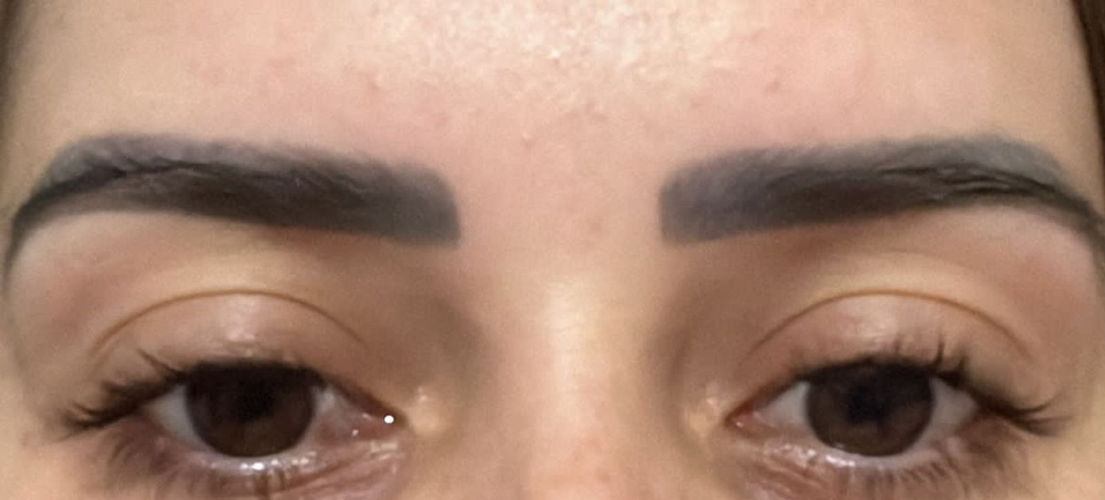 Sobrancelha com micropigmentação escura antes